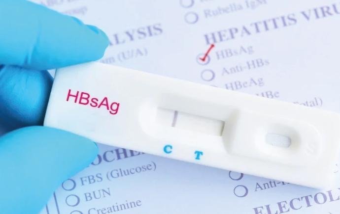 HBSAG Hepatitis B