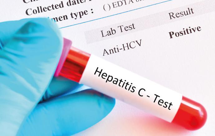 HCV Hepatitis C